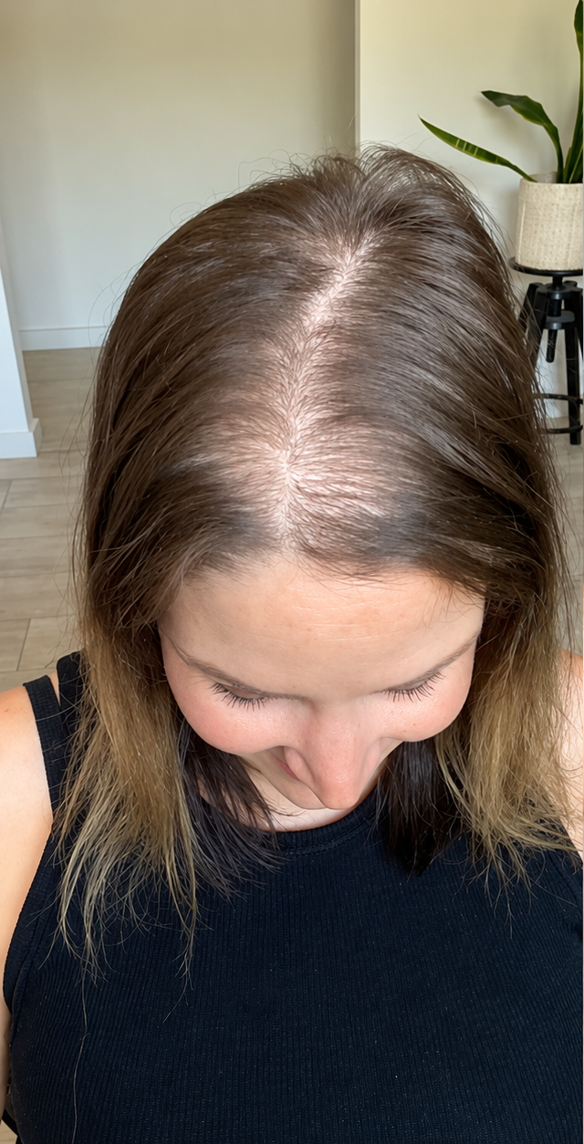 Antes